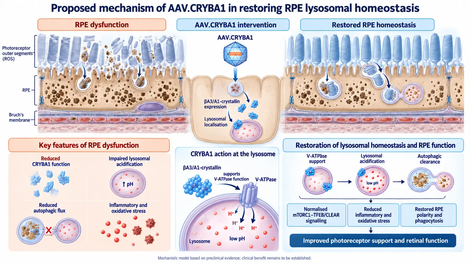 Proposed mechanism of AAV.CRYBA1: RPE dysfunction, AAV.CRYBA1 intervention with βA3/A1-crystallin expression and lysosomal localisation, and restored RPE homeostasis through V-ATPase support, lysosomal acidification and autophagic clearance.